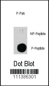 Anti-TSC2 Rabbit Polyclonal Antibody