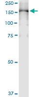 Anti-PLCG2 Polyclonal Antibody Pair