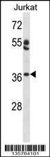 Anti-OVOL1 Rabbit Polyclonal Antibody (APC (Allophycocyanin))