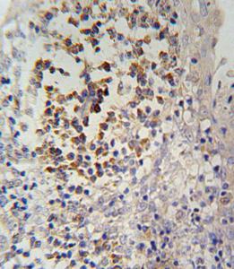 Anti-IL12RB2 Rabbit Polyclonal Antibody (PE (Phycoerythrin))