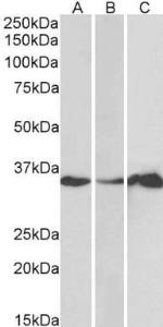 Anti-LASP1 Antibody (A83800) (1 µg/ml) staining of Human Cerebellum (A), Colon (B) and Duodenum (C) lysate (35 µg protein in RIPA buffer). Primary incubation was 1 hour. Detected by chemiluminescence