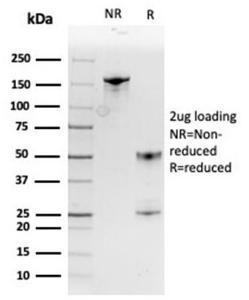 Anti-MIF antibody