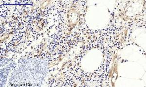 Immunohistochemical analysis of paraffin-embedded human Appendix tissue using Anti-Fos Antibody at 1:200 (4°C overnight). Negative control was secondary antibody only.