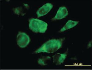 Anti-SSR4 Mouse Monoclonal Antibody [clone: 2D3]