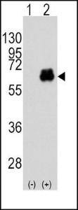 Anti-MYC Rabbit Polyclonal Antibody (AP (Alkaline Phosphatase))