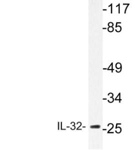 Western blot analysis of lysate from HepG2 cells using Anti-IL-32 Antibody