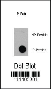 Anti-EIF4EBP1 Rabbit Polyclonal Antibody