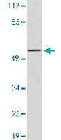 Anti-BMP6 Rabbit Polyclonal Antibody