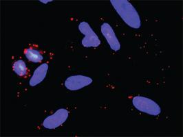 Anti-CACYBP + SIAH1 Antibody Pair