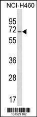 Anti-GPATCH4 Rabbit Polyclonal Antibody (PE (Phycoerythrin))