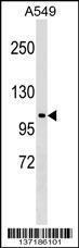 Anti-HECTD3 Rabbit Polyclonal Antibody (FITC (Fluorescein Isothiocyanate))