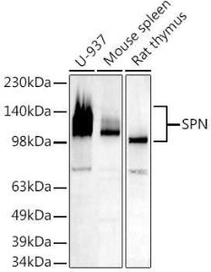 Western blot analysis of extracts of various cell lines, using Anti-CD43 Antibody (A9855) at 1:500 dilution. The secondary antibody was Goat Anti-Rabbit IgG H&L Antibody (HRP) at 1:10,000 dilution.