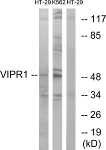 Western blot analysis of lysates from HT-29 and K562 cells using Anti-VIPR1 Antibody. The right hand lane represents a negative control, where the Antibody is blocked by the immunising peptide