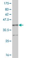 Anti-NR4A2 Mouse Monoclonal Antibody [clone: 1D9]