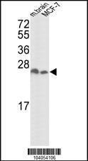 Anti-14-3-3 delta/zeta Rabbit Polyclonal Antibody (APC (Allophycocyanin))