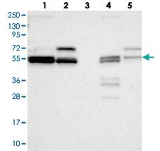 Anti-LACTB Rabbit Polyclonal Antibody