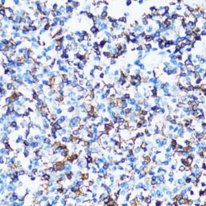 Immunohistochemistry analysis of paraffin-embedded human tonsil using Anti-CD43 Antibody (A9855) at a dilution of 1:100 (40x lens). Perform microwave antigen retrieval with 10 mM PBS buffer pH 7.2 before commencing with IHC staining protocol.