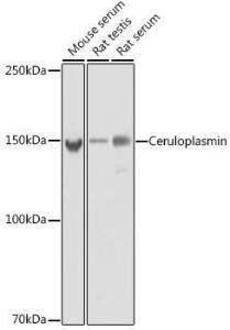 Western blot analysis of extracts of various cell lines, using Anti-Ceruloplasmin Antibody [ARC5018-06] (A306336) at 1:5,000 dilution. The secondary antibody was Goat Anti-Rabbit IgG H&L Antibody (HRP) at 1:10,000 dilution.