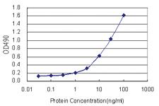 Anti-PRKRA Polyclonal Antibody Pair