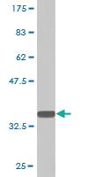 Anti-PQBP1 Mouse Monoclonal Antibody [clone: 1A11]