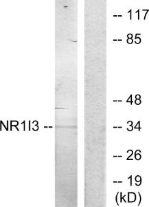 Anti-NR1I3 antibody