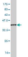 Anti-ZFP36L1 Mouse Monoclonal Antibody [clone: 1A3]