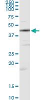 Anti-CKM Antibody Pair