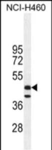 Anti-FGL2 Rabbit Polyclonal Antibody