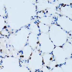 Immunohistochemistry analysis of paraffin-embedded mouse lung using Anti-CD43 Antibody (A9855) at a dilution of 1:100 (40x lens). Perform microwave antigen retrieval with 10 mM PBS buffer pH 7.2 before commencing with IHC staining protocol.