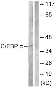 Western blot analysis of lysates from COS7 cells, treated with EGF 200 ng/ml 30' using Anti-CEBP alpha Antibody. The right hand lane represents a negative control, where the Antibody is blocked by the immunising peptide