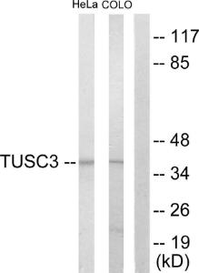 Anti-TUSC3 antibody