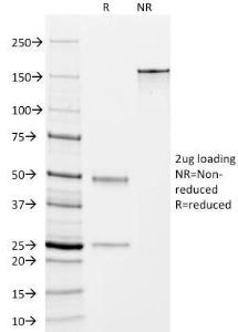 SDS-PAGE analysis of Anti-TMEM16A Antibody [DG1/447] under non-reduced and reduced conditions; showing intact IgG and intact heavy and light chains, respectively. SDS-PAGE analysis confirms the integrity and purity of the antibody