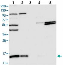 Anti-FAM136A Rabbit Polyclonal Antibody