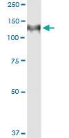 Anti-HIP1 Antibody Pair