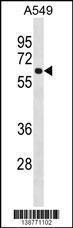 Anti-FCRL1 Rabbit Polyclonal Antibody (FITC (Fluorescein Isothiocyanate))