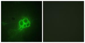 Immunofluorescence analysis of HUVEC cells using Anti-Tryptophan Hydroxylase Antibody. The right hand panel represents a negative control, where the antibody was pre-incubated with the immunising peptide.