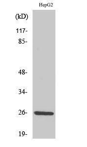 Western blot analysis of various cells using Anti-IL-32 Antibody