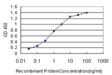 Anti-NVL Mouse Monoclonal Antibody [clone: 3F6]