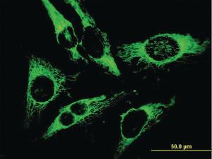 Anti-PRDX3 Mouse Monoclonal Antibody [clone: 1E3-B2]