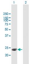 Anti-C1QTNF3 Mouse Polyclonal Antibody