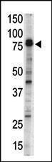 Anti-DCLK1 Rabbit Polyclonal Antibody (Biotin)