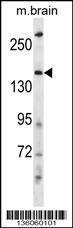 Anti-HECW2 Rabbit Polyclonal Antibody (FITC (Fluorescein Isothiocyanate))