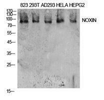 Western blot analysis of extracts from 823, 293T, AD293, Hela, HepG2 cells using Anti-NOXIN Antibody