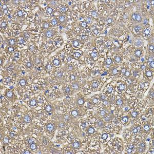 Immunohistochemistry analysis of paraffin-embedded rat liver using Anti-Ceruloplasmin Antibody [ARC5018-06] (A306336) at a dilution of 1:100 (40x lens). Perform high pressure antigen retrieval with 10 mM citrate buffer pH 6.0 before commencing with IHC staining protocol.