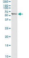 Anti-PTGIS Polyclonal Antibody Pair