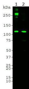 Western blot analysis of Anti-a Subunit Of Complement Component 4 Antibody on human serum samples. Blot of 0.1 µg purified human C3 protein (Lane 1), 10&nbsp;µg normal human serum proteins (Lane 2) was probed with Anti-a Subunit Of Complement Component 4 Antibody (1:5,000).