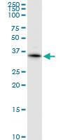 Anti-KCNIP2 Rabbit Polyclonal Antibody