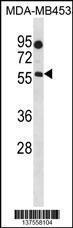 Anti-B4GALNT1 Rabbit Polyclonal Antibody (HRP (Horseradish Peroxidase))