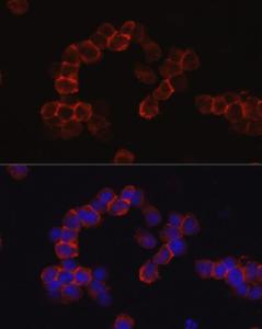 Immunofluorescence analysis of Jurkat cells using Anti-CD43 Antibody (A9855) at a dilution of 1:50 (40x lens). DAPI was used to stain the cell nuclei (blue).