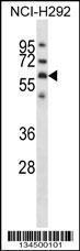 Anti-GPC3 Rabbit Polyclonal Antibody (APC (Allophycocyanin))